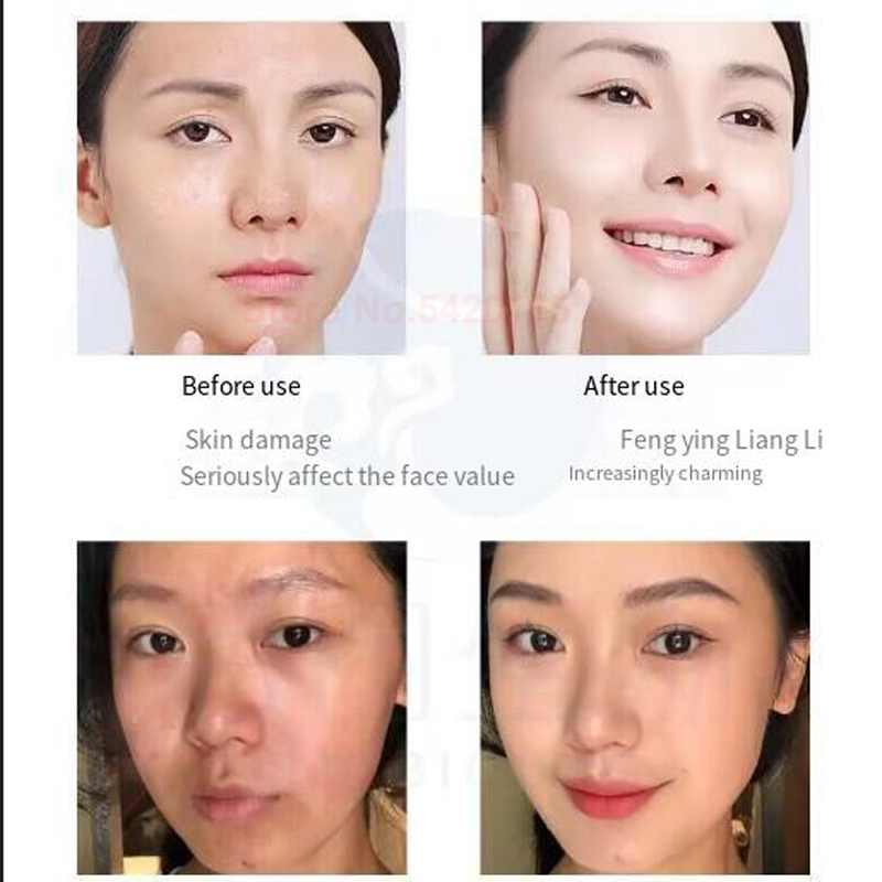 سيروم مسحوق الببتيد النحاسي ال - مراجعة Valerian Root Capsule وسعره